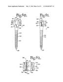 DYNAMIC SPINAL STABILIZATION ASSEMBLIES, TOOL SET AND METHOD diagram and image