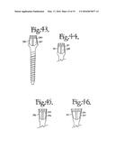 DYNAMIC SPINAL STABILIZATION ASSEMBLIES, TOOL SET AND METHOD diagram and image