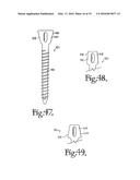 DYNAMIC SPINAL STABILIZATION ASSEMBLIES, TOOL SET AND METHOD diagram and image