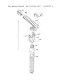 DYNAMIC SPINAL STABILIZATION ASSEMBLIES, TOOL SET AND METHOD diagram and image