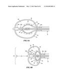 BALLOON DESIGN TO ENHANCE COOLING UNIFORMITY diagram and image
