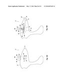 DEPLOYMENT MECHANISMS FOR SURGICAL INSTRUMENTS diagram and image