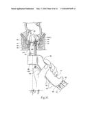 SYSTEMS AND METHODS FOR TREATING DYSFUNCTIONS IN THE INTESTINES AND RECTUM     THAT ADAPT TO THE ANATOMIC FORM AND STRUCTURE OF DIFFERENT INDIVIDUALS diagram and image