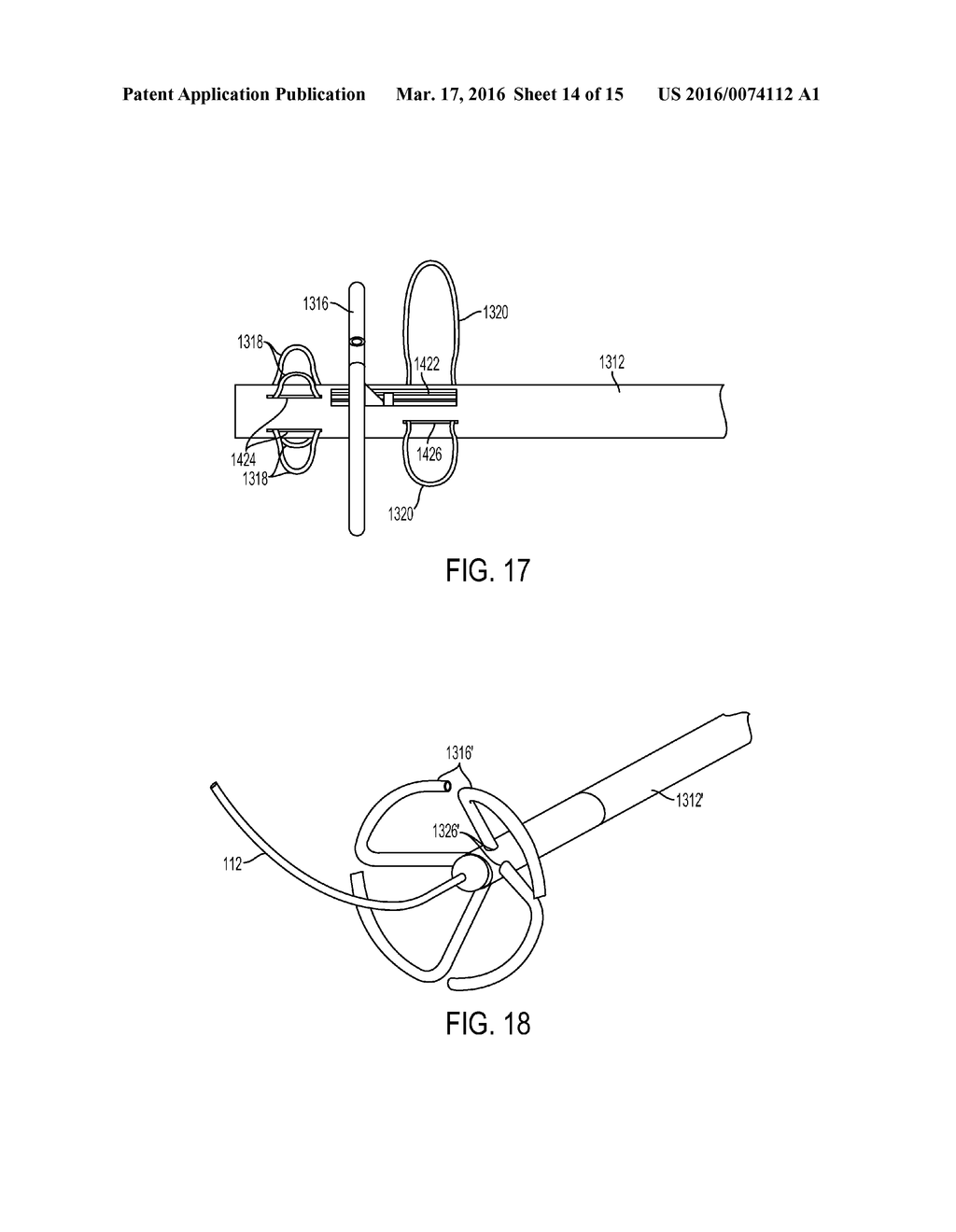 ABLATION CATHETERS  AND METHODS OF USE THEREOF - diagram, schematic, and image 15