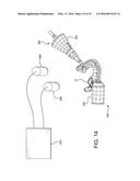 System for Determining and Tracking Movement During a Medical Procedure diagram and image