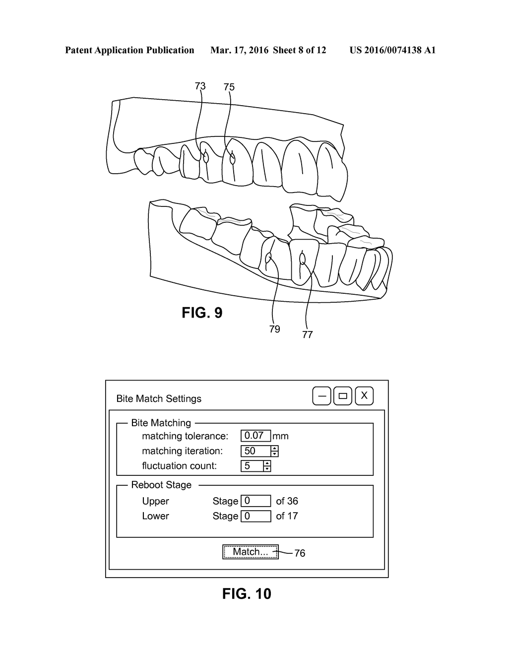 SYSTEM AND METHOD FOR DETECTING DEVIATIONS DURING THE COURSE OF AN     ORTHODONTIC TREATMENT TO GRADUALLY REPOSITION TEETH - diagram, schematic, and image 09