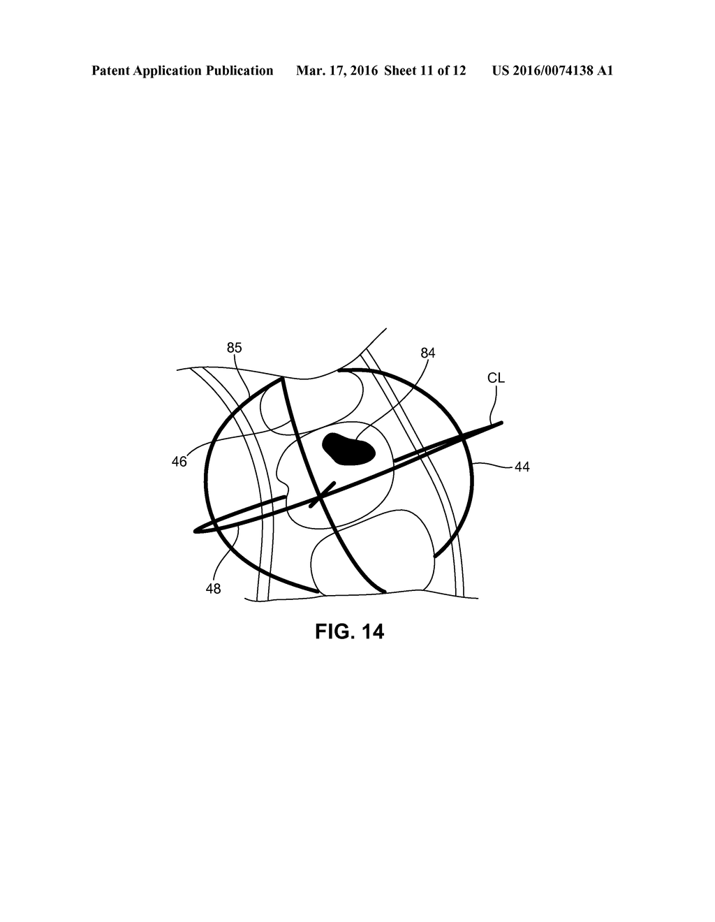 SYSTEM AND METHOD FOR DETECTING DEVIATIONS DURING THE COURSE OF AN     ORTHODONTIC TREATMENT TO GRADUALLY REPOSITION TEETH - diagram, schematic, and image 12