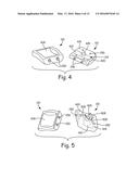 IMPROVED ANKLE REPLACEMENT APPARATUS AND METHOD diagram and image