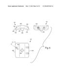 IMPROVED ANKLE REPLACEMENT APPARATUS AND METHOD diagram and image