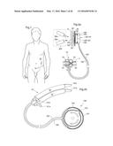 RESTRICTION DEVICE diagram and image