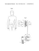 RESTRICTION DEVICE diagram and image