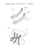 NECK ORTHOSIS diagram and image