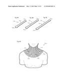 NECK ORTHOSIS diagram and image