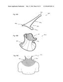 NECK ORTHOSIS diagram and image