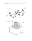 NECK ORTHOSIS diagram and image