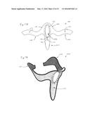 NECK ORTHOSIS diagram and image