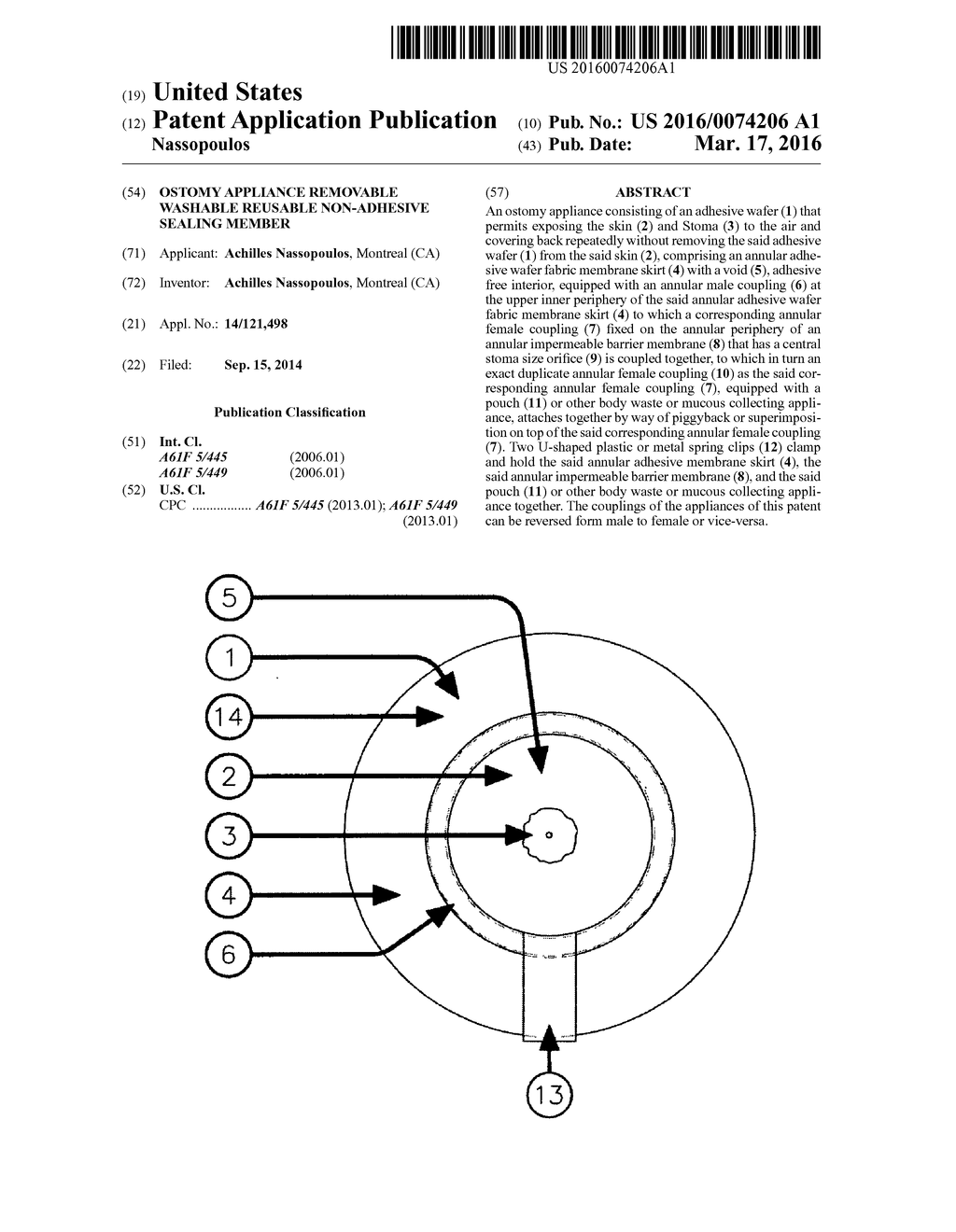 Ostomy appliance removable washable reusable non-adhesive sealing member - diagram, schematic, and image 01