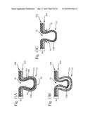 Absorbent Articles diagram and image