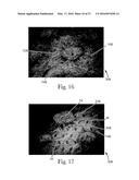 Absorbent Articles diagram and image