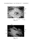 Absorbent Articles diagram and image