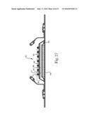 Absorbent Articles diagram and image