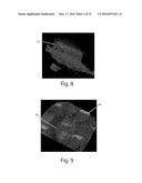 Nonwoven Material Having Discrete Three-Dimensional Deformations With Wide     Base Openings That are Base Bonded to Additional Layer diagram and image