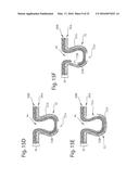 Nonwoven Material Having Discrete Three-Dimensional Deformations With Wide     Base Openings That are Base Bonded to Additional Layer diagram and image