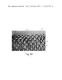 Nonwoven Material Having Discrete Three-Dimensional Deformations With Wide     Base Openings That are Base Bonded to Additional Layer diagram and image