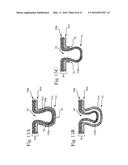 Absorbent Articles diagram and image