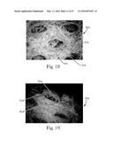 Absorbent Articles diagram and image