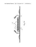 Absorbent Articles diagram and image