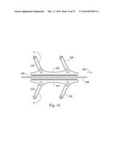 Strip for the Delivery of an Oral Care Active and Methods for Applying     Oral Care Actives diagram and image