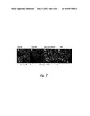 WNT MODULATORS FOR THE PROTECTION, MITIGATION AND TREATMENT OF RADIATION     INJURY diagram and image