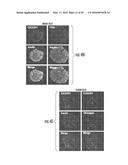 Novel Target for Diagnosis and Treatment of Diabetes and Cardiovascular     Diseases diagram and image