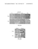 CLOSTRIDIUM DIFFICILE VACCINE AND METHODS OF USE diagram and image