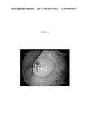 EMULSIONS OR MICROEMULSIONS FOR USE IN ENDOSCOPIC MUCOSAL RESECTIONING     AND/OR ENDOSCOPIC SUBMUCOSAL DISSECTION diagram and image