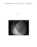 EMULSIONS OR MICROEMULSIONS FOR USE IN ENDOSCOPIC MUCOSAL RESECTIONING     AND/OR ENDOSCOPIC SUBMUCOSAL DISSECTION diagram and image