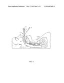 TRACHEAL TUBES AND METHODS RELATED THERETO diagram and image