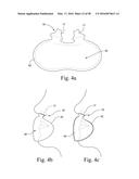 COMPACT ORONASAL PATIENT INTERFACE diagram and image