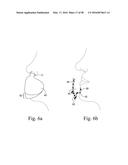 COMPACT ORONASAL PATIENT INTERFACE diagram and image