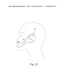 COMPACT ORONASAL PATIENT INTERFACE diagram and image