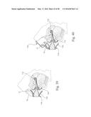 COMPACT ORONASAL PATIENT INTERFACE diagram and image