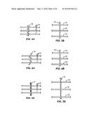 DEVICE AND METHOD FOR COMPARTMENTAL VESSEL TREATMENT diagram and image