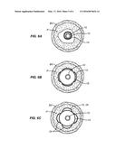 DEVICE AND METHOD FOR COMPARTMENTAL VESSEL TREATMENT diagram and image