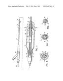 CATHETER HAVING TRANSITIONING SHAFT SEGMENTS diagram and image