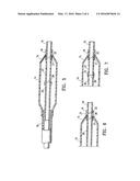 CATHETER HAVING TRANSITIONING SHAFT SEGMENTS diagram and image