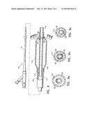 CATHETER HAVING TRANSITIONING SHAFT SEGMENTS diagram and image