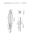 CATHETER HAVING TRANSITIONING SHAFT SEGMENTS diagram and image