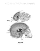 PLANNING SYSTEM FOR TARGETING TISSUE STRUCTURES WITH ULTRASOUND diagram and image