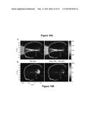 PLANNING SYSTEM FOR TARGETING TISSUE STRUCTURES WITH ULTRASOUND diagram and image